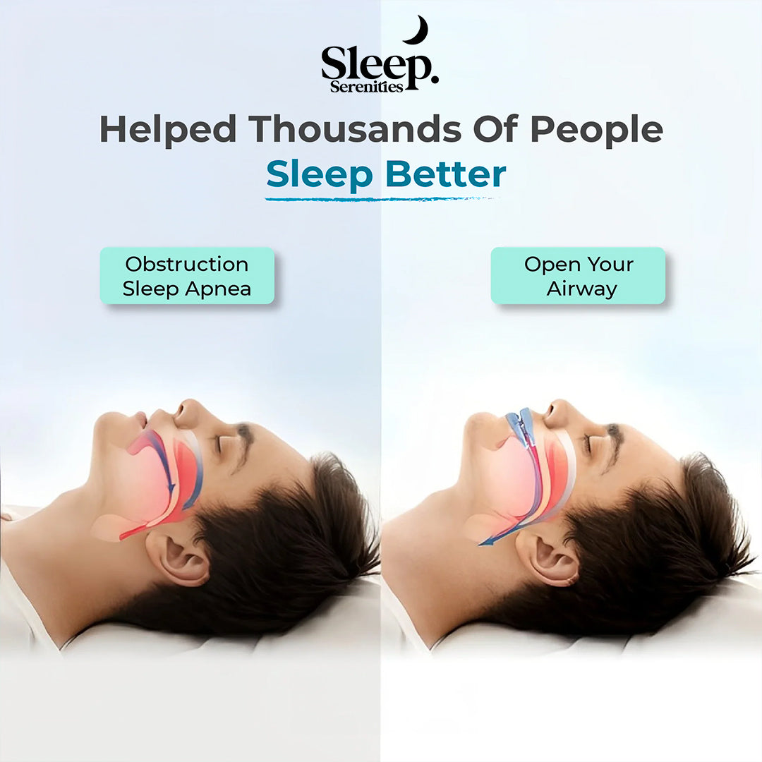 The DreamGuard Anti-Snoring Mouthpiece